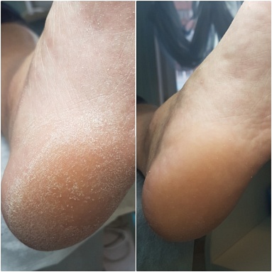 ����9